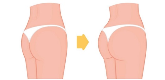 Brazilian Butt
