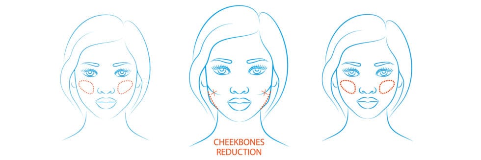 how to get rid of cheekbone lines