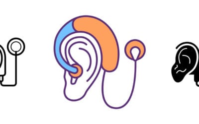 Cochlear Implant