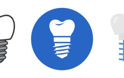 Dental Implant